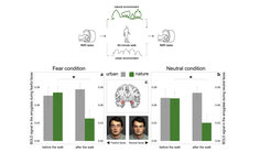 Top: schematic overview of the study design. Bottom: bilateral amygdala activity during the Fearful Faces Task